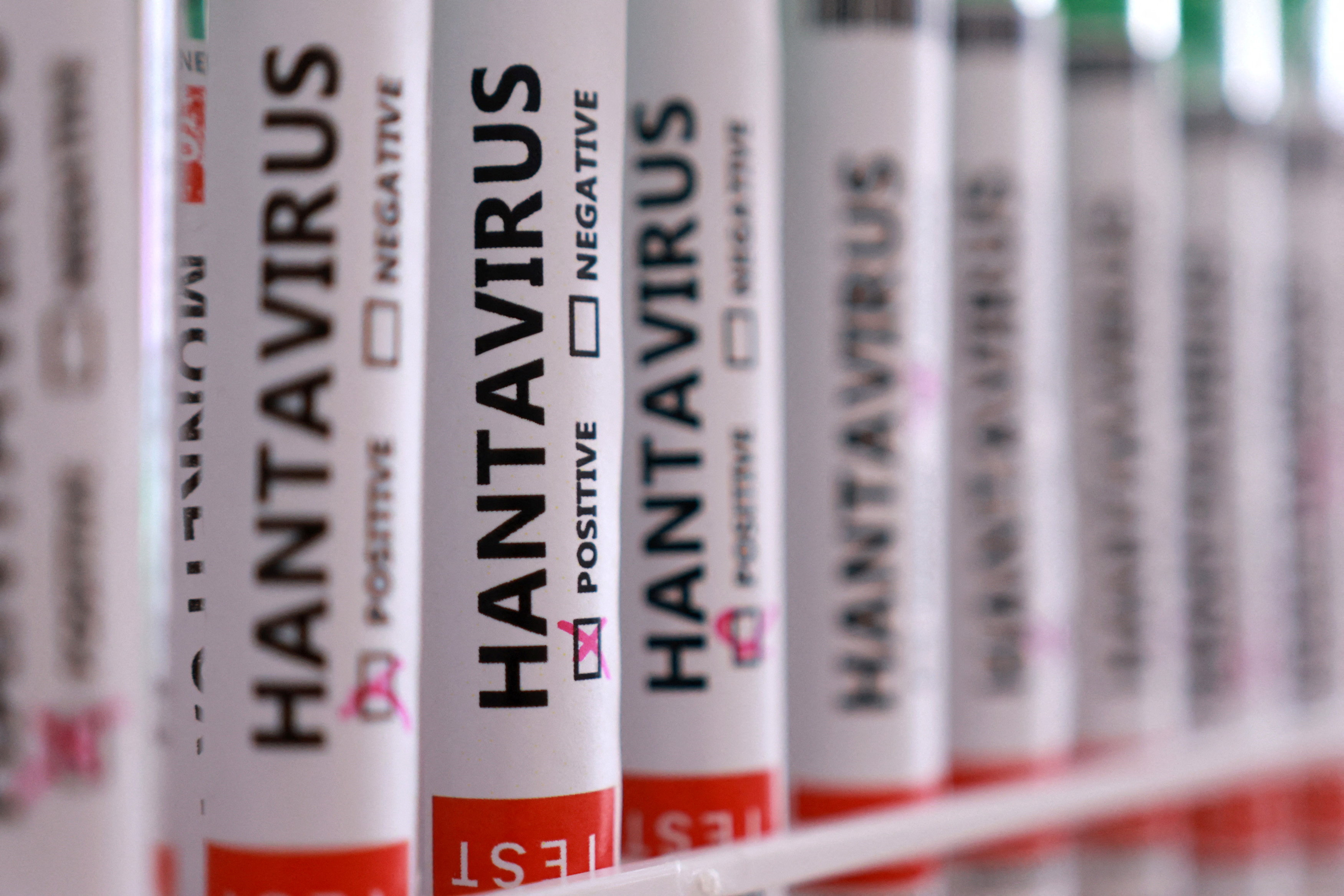 Hantavirüs Alarmı Sona Erdi! Kabin Memurunun Test Sonucu Açıklandı! Herkes Rahat Bir Nefes Aldı!