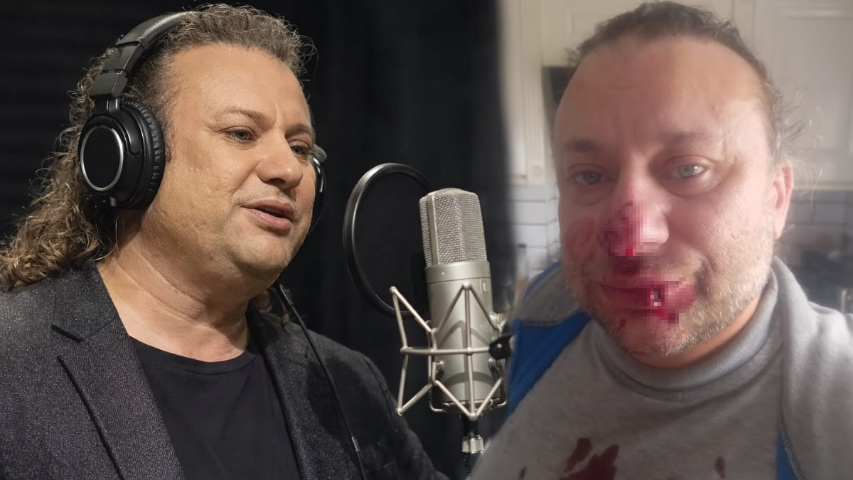 Şoke Eden Haber! Ünlü Sanatçı Et Yiyen Bakteriyle Ölüm Kalım Savaşı Veriyor!